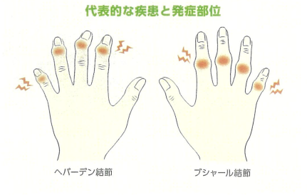 代表的な疾患と発症部位